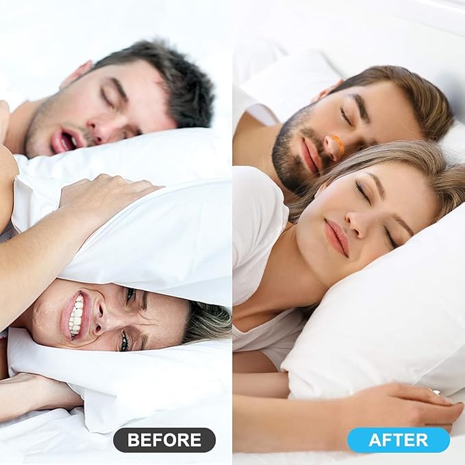 MagnoBreathe β Magnetic Anti-Snore Nasal Strips & Dilator Clip